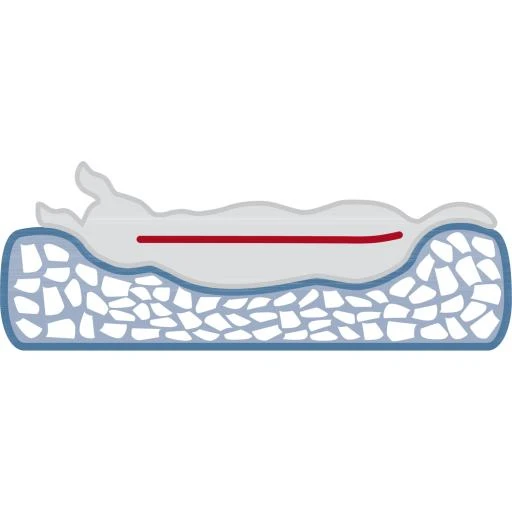 Trixie Vital Pulito Grey Bed 16 Trixie Vital Pulito Grey Bed - Image 16